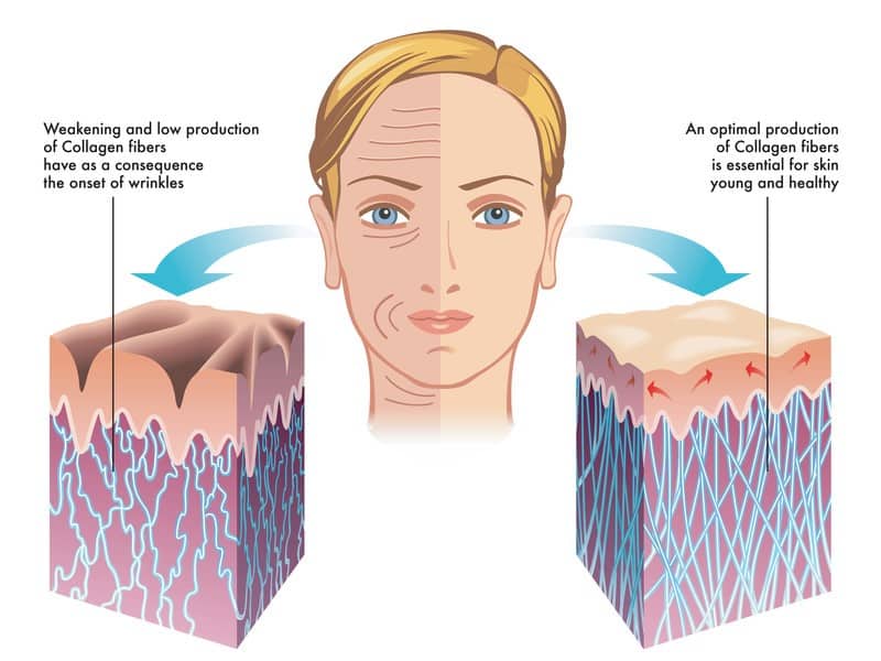 Collagen for skin regeneration