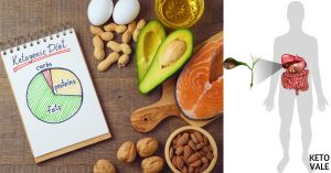 Can You Follow a Keto Diet Without a Gallbladder?